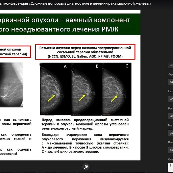 Межрегиональная научно-практическая конференция «Сложные вопросы в диагностике и лечении рака молочной железы», 04.06.2020 - фото 24