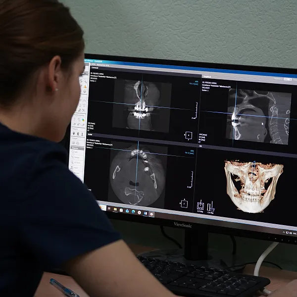 В ТвГМУ прошла 13-я Внутривузовская Олимпиада по ортопедической стоматологии - фото 6
