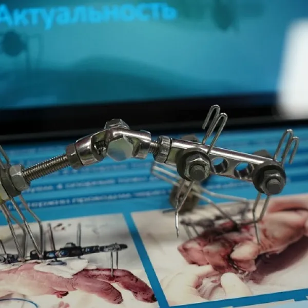 Ректор Тверского медуниверситета представил Губернатору разработки ученых вуза  - фото 7