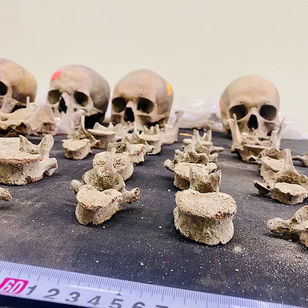 В летней школе Тверского медуниверситета изучают коллекцию останков XVIII века - фото 1