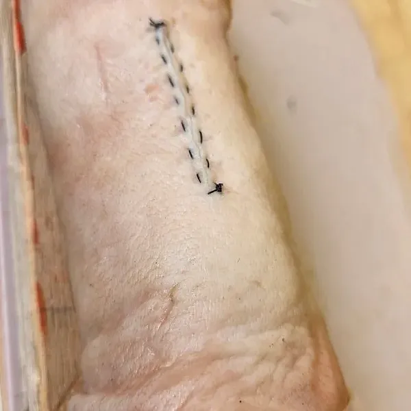 В ТвГМУ подвели итоги второй внутривузовской олимпиады по базовым хирургическим навыкам - фото 4